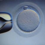 Procreazione medicalmente assistita. In Sicilia sono solo 7 i centri pubblici