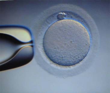 Procreazione medicalmente assistita. In Sicilia sono solo 7 i centri pubblici Procreazione medicalmente assistita. In Sicilia sono solo 7 i centri pubblici