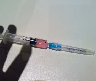 Aids, non abbassare la guardia sul fronte della prevenzione Aids, non abbassare la guardia sul fronte della prevenzione