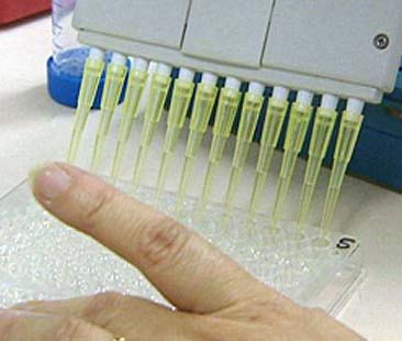 Epatite C: Sicilia tra le più colpite. Ogni anno 3 mila morti per cirrosi