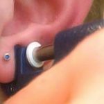 Il foro nel lobo per gli orecchini. Misure per prevenire le infezioni