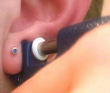 Il foro nel lobo per gli orecchini. Misure per prevenire le infezioni