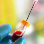 Muore bimbo palermitano, ai genitori negato il metodo Stamina