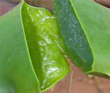 Le tante proprietà dell’aloe vera contro scottature ed inestetismi Le tante proprietà dell’aloe vera contro scottature ed inestetismi