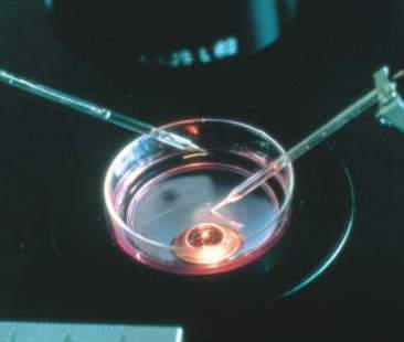 Fecondazione eterologa ok, il divieto è incostituzionale