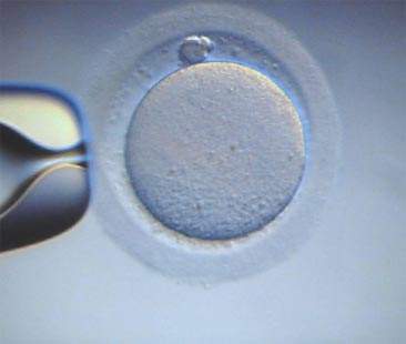 Fecondazione eterologa, si può. Stop al “turismo procreativo”