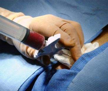 Midollo osseo, necessari mille donatori effettivi per anno