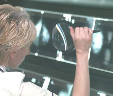 Diffusion Whole Body, la lotta al cancro ha un nuovo “alleato” Diffusion Whole Body, la lotta al cancro ha un nuovo “alleato”