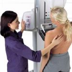 Catania, mammografie gratis. Prevenire può salvare la vita