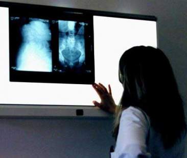 Tumori: al Sud ci si ammala meno ma si muore più che al Nord