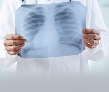 Tumori, colpite mille persone al giorno. In 11 anni +36% cancro polmone nelle donne