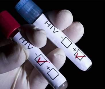 A Catania test gratuito per l’Hiv