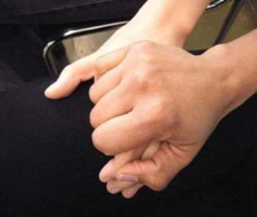 Dalla riforma sostegno ai disabili gravi