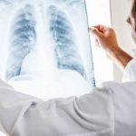 Cancro negli under 40, 30 diagnosi al giorno