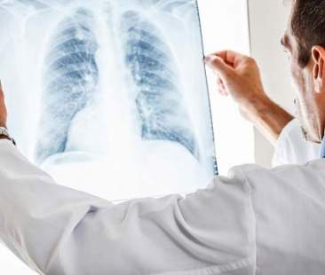 Cancro negli under 40, 30 diagnosi al giorno Cancro negli under 40, 30 diagnosi al giorno