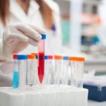 Replicazione di Ebola nelle vie respiratorie al centro di uno studio dell’Inmi di Roma