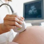 In Sicilia il 42,5% dei bimbi nasce con parto cesareo