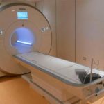 Sindrome da conflitto neuro vascolare, diagnosi con risonanza magnetica