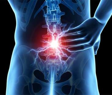 Lo SpineMED per il trattamento di lombalgia e cervicobrachialgia