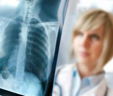 Maggiore dialogo fra paziente e medico per contrastare la Bpco con più efficacia Maggiore dialogo fra paziente e medico per contrastare la Bpco con più efficacia