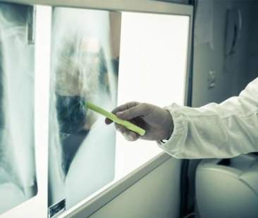 Tumori, in Sicilia stimate oltre 70 diagnosi al giorno