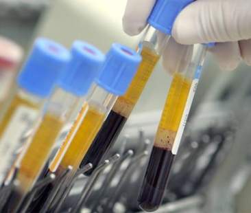 Focus sulle malattie del sangue