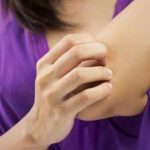 Psoriasi, 200 mila siciliani affetti ma le diagnosi arrivano in ritardo