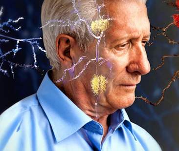 Alzheimer, 2017 anno di novità per la prevenzione della malattia