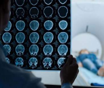 Sei giovani per il “Brain your time award” un premio nella lotta alla sclerosi multipla