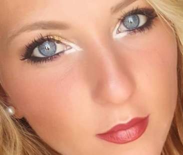 Parigi: Angela rischia l’amputazione di una gamba