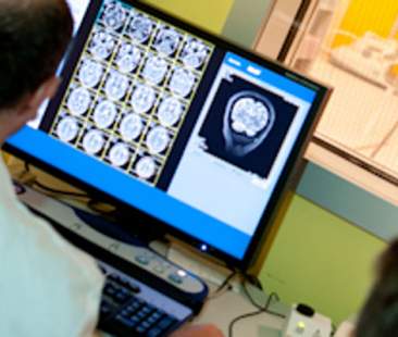 Ictus, in Sicilia ancora troppe ospedalizzazioni