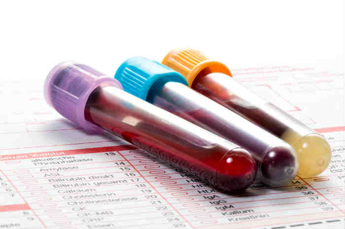Malattie infettive emergenti, nuove sfide per sangue italiano