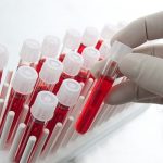 Al via la II edizione della campagna “Ridisegniamo l’emofilia”