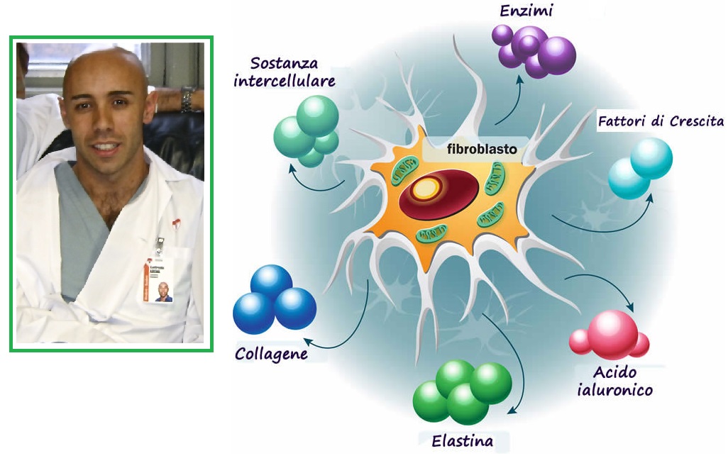 Tumori, le vescicole untrici infettano le cellule sane Tumori, le vescicole untrici infettano le cellule sane