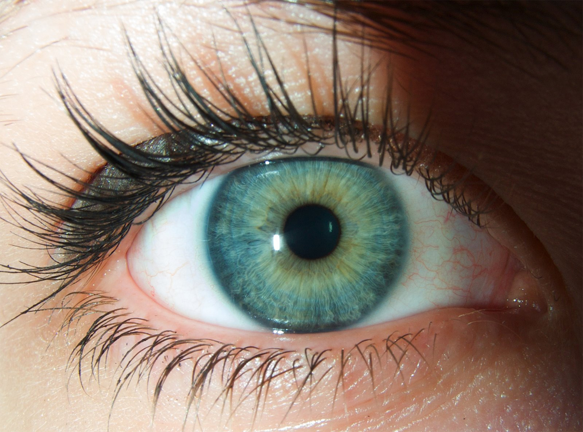 Cheratite da Acanthamoeba, rara infezione che può far perdere la vista, i sintomi