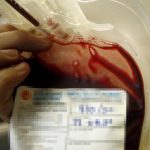 Caltanissetta, morto per Epatite C, condannato ministero Salute