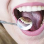 Allarme degli esperti sui tumori orofaringei in dieci anni casi aumentati di circa il 300%