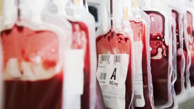 Emergenza sangue a Catania, “Donate per talassemici e emoblobinopatici”