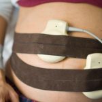 Donna gravida operata a Palermo, come riconoscere un’anomalia di impianto placentare