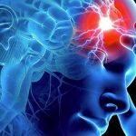 Salute, ogni anno 120mila  persone in Italia colpite da ictus