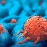 In aumento l’incidenza di tumori nelle donne ma si riduce il tasso di mortalità negli uomini