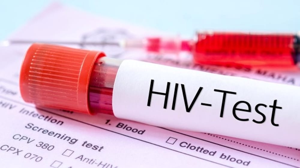 Hiv, per la prima volta dal 2010 meno diagnosi
