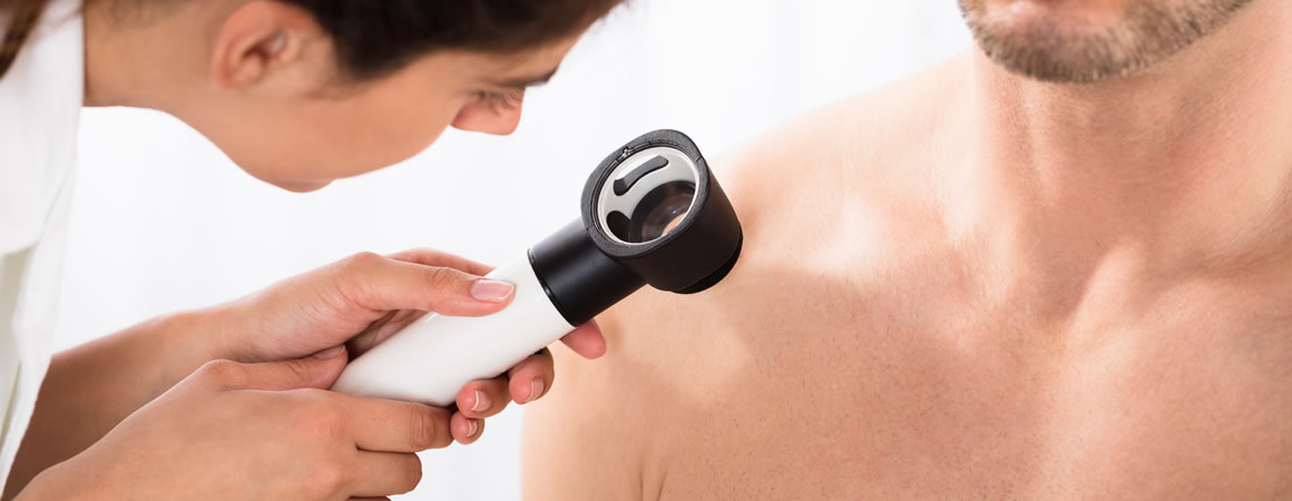 Medicina di precisione contro i melanoma, la ricerca continua a compiere nuovi passi