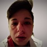 Pestata a Potenza perché lesbica, pubblica le foto choc sui social