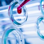 Covid, intesa AstraZeneca-Biologika per nuova produzione vaccini