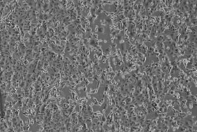 Galleria foto 'Coronavirus isolato dagli specialisti dello Spallanzani di Roma' - foto 2