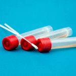 Iss, “Irrealistico e poco utile l’allargamento dei tamponi”