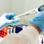 Covid, scoperto gene che rende virus letale, ecco perché pazienti si aggravano