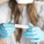 Covid, plasma iperimmune è inefficace in pazienti con polmonite