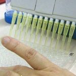 Coronavirus, il diabete non aumenta le possibilità di contrarre l’infezione